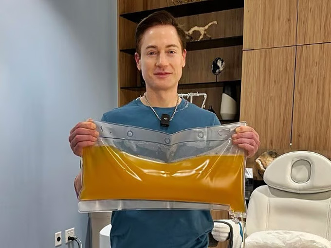 미국의 억만장자 브라이언 존슨은 2023년 18살 아들의 혈액에서 분리한 혈장을 수혈받았다. /사진=브라이언 존슨 인스타그램 