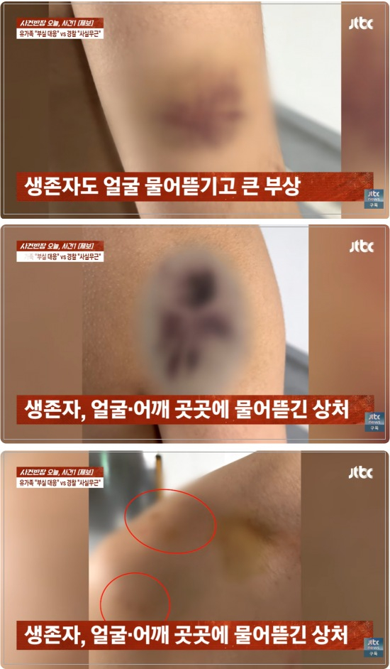 경북 경산에서 20대 남성이 친구를 살해한 사건이 벌어진 지난 4일 현장에 함께 남아있던 또다른 친구 A씨도 피의자로부터 폭행을 당한 것으로 확인됐다. /사진=JTBC 사건반장 캡처