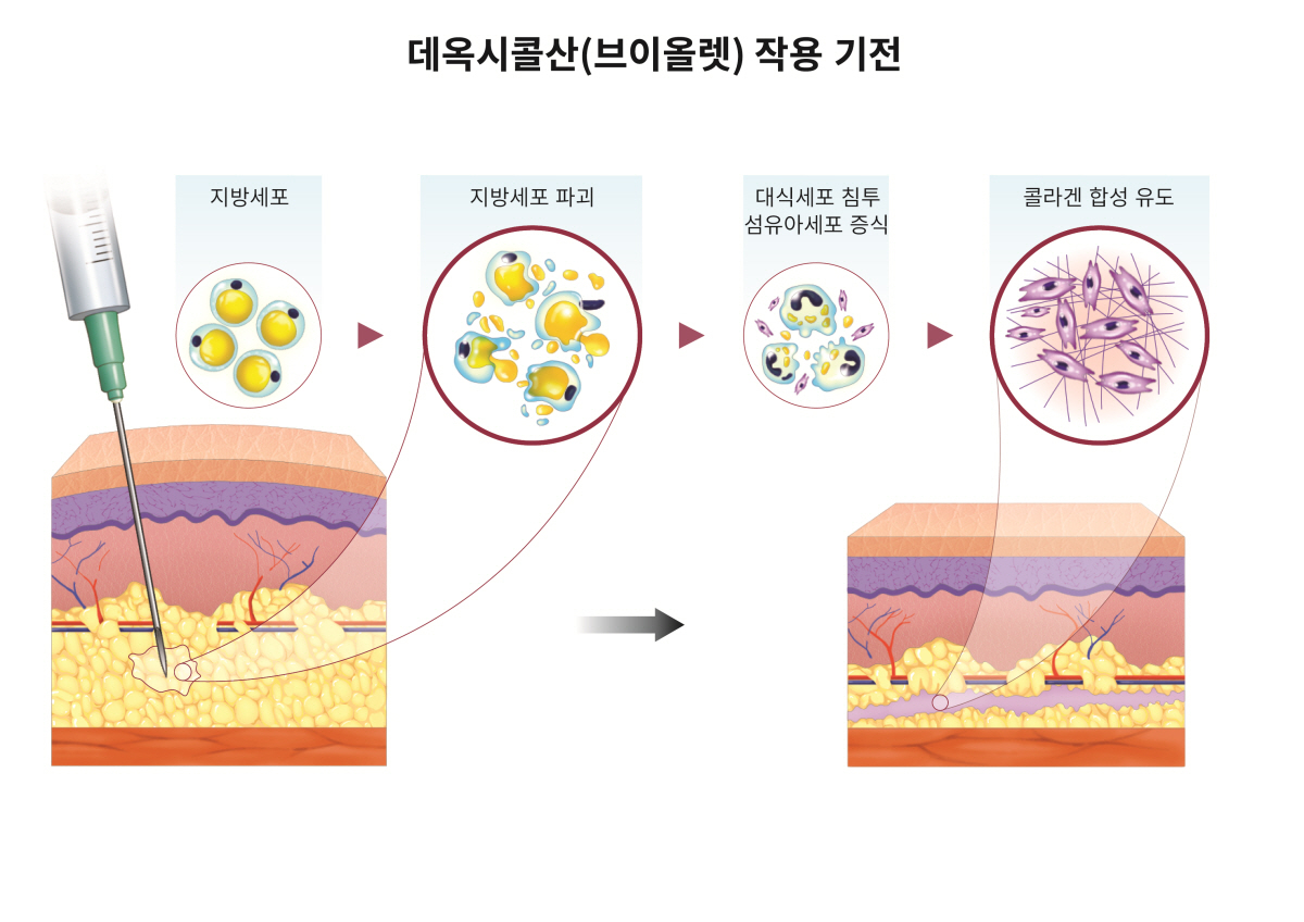 데옥시콜산 작용기전./사진=대웅제약