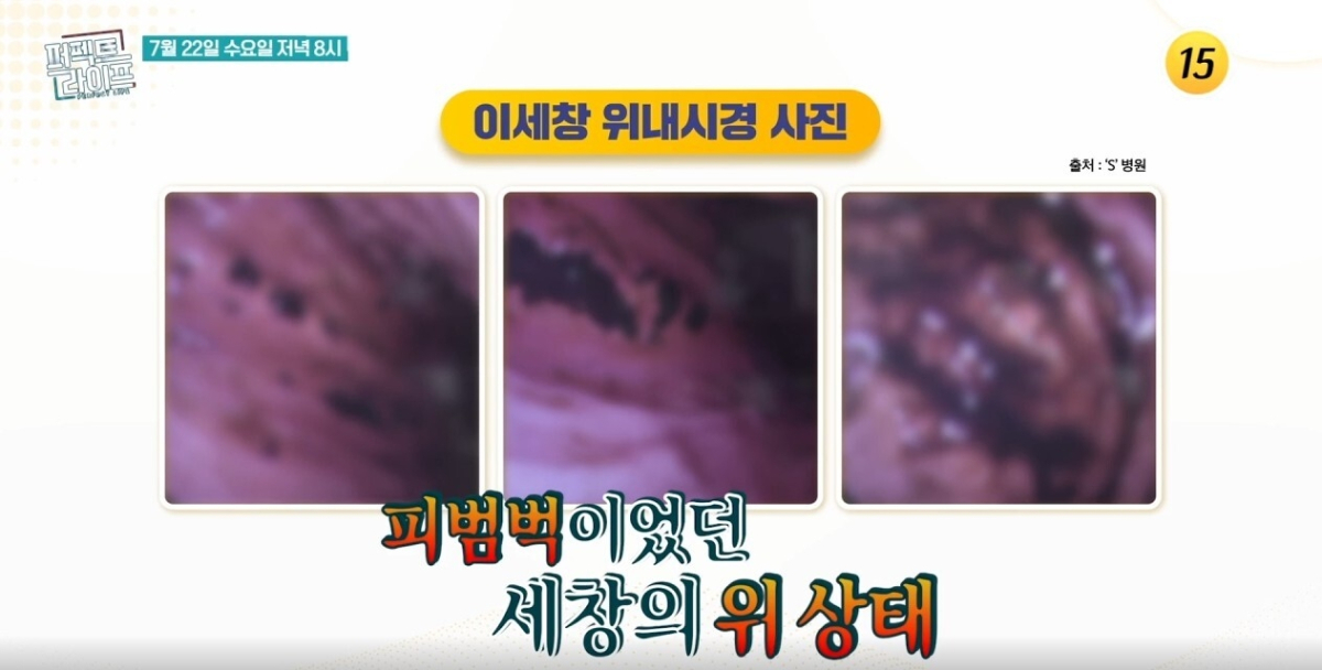배우 이세창이 과거 위내시경 검사에서 피범벅 상태의 위 상태를 확인했다고 밝힌다. /사진=TV조선 '퍼펙트 라이프' 예고편