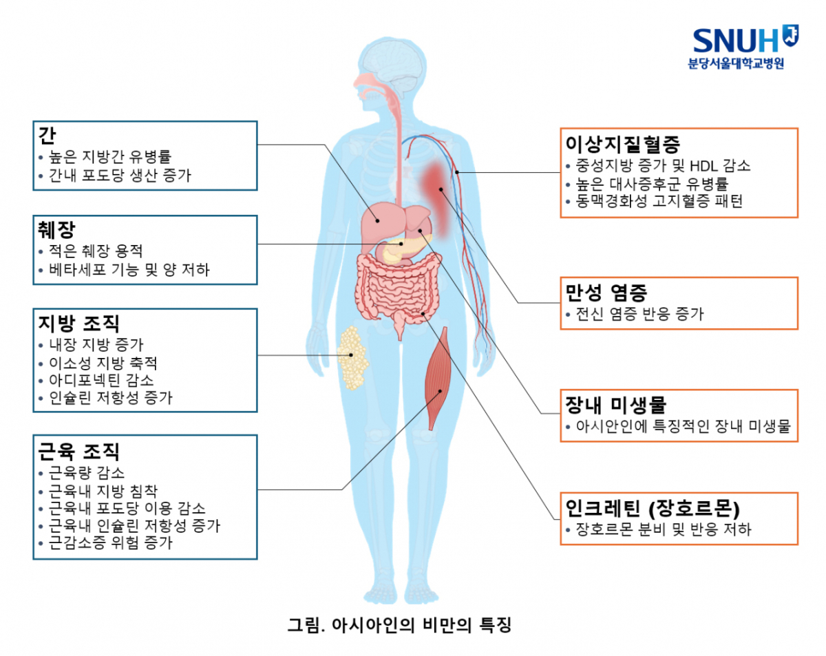 아시아인 비만의 특징. /사진제공=분당서울대병원