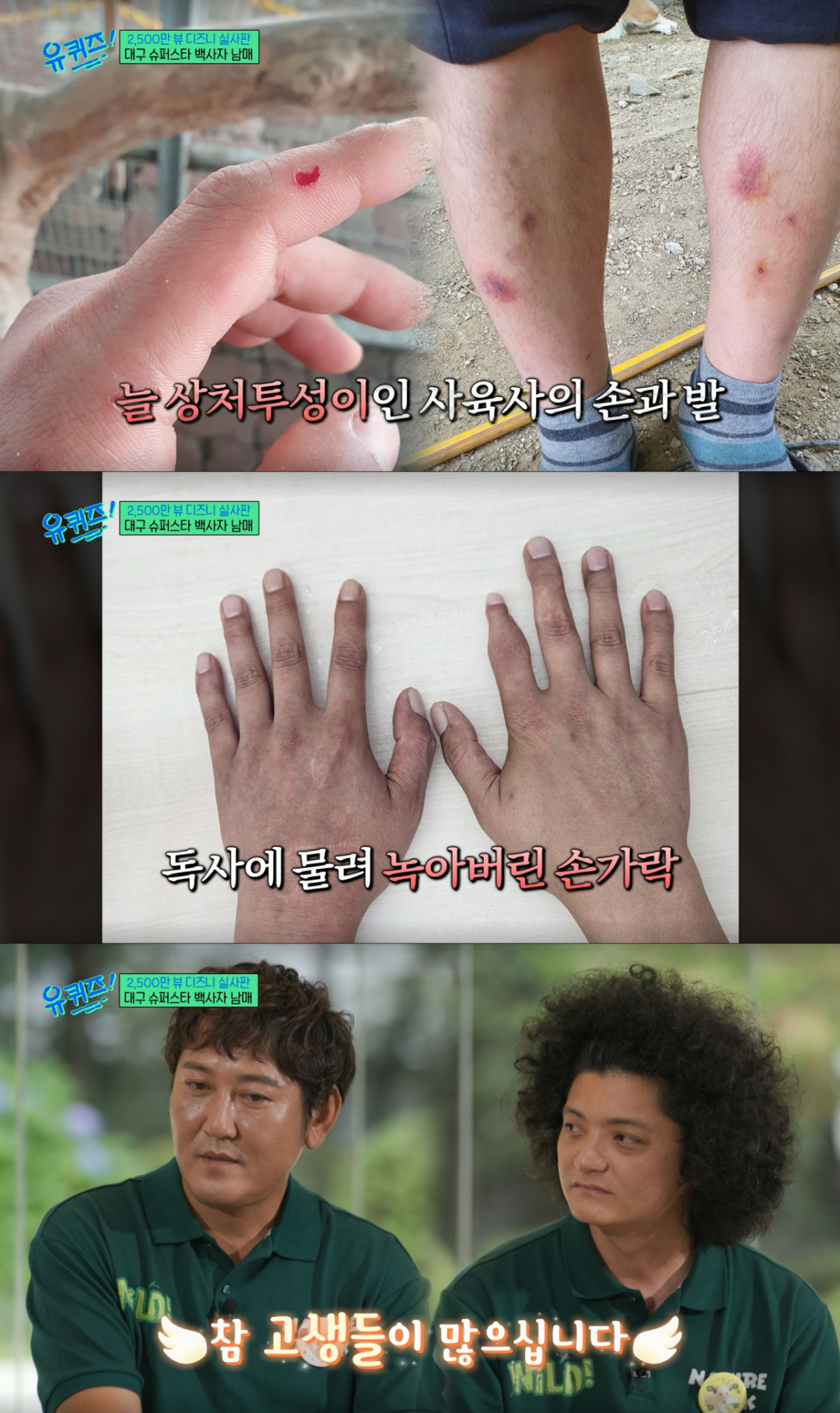 동물들에게 물려 상처가 남은 사육사들. /사진=tvN '유 퀴즈 온 더 블럭' 캡처