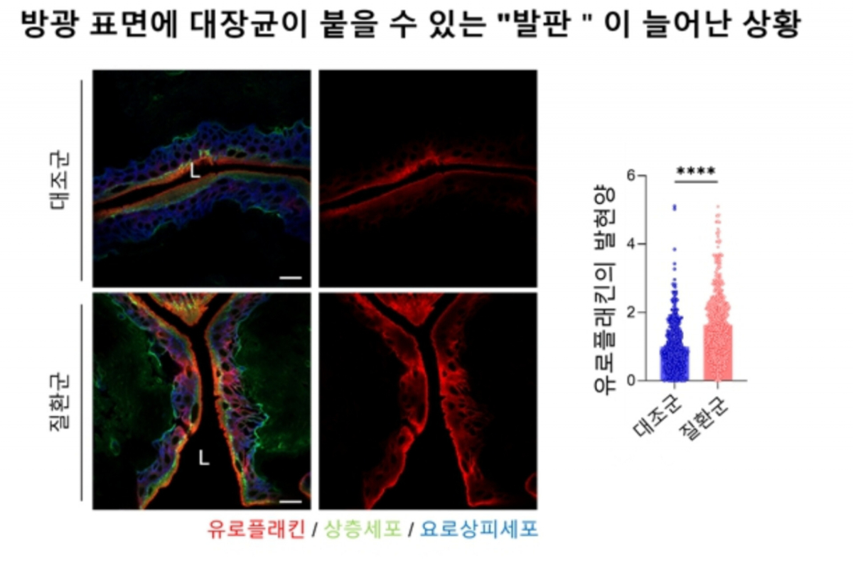 방광염이 잘 재발하는 환자에게 자주 관찰되는 세균이 '가드너렐라 피오티'다. 이 세균이 분비하는 숙신산이 방광 세포의 특정 수용체(GPR91)를 자극하면 방광 표면에 유로플라킨이라는 단백질이 훨씬 많이 만들어진다. 대장균은 이 단백질에 달라붙어 방광을 감염시킨다./자료=해당 연구팀