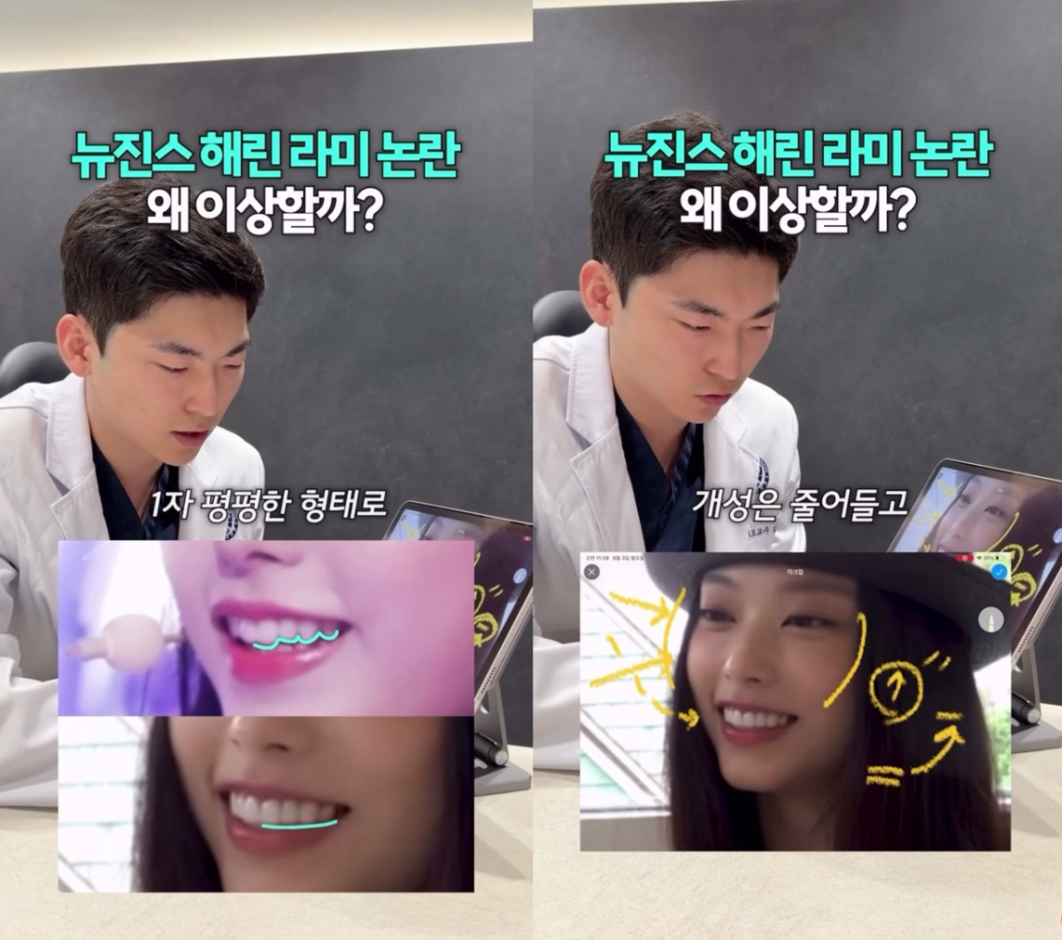 김건민 연세건호치과 대표원장이 뉴진스 해린의 달라진 치열에 대해 분석을 내놨다. /사진=유튜브 '건원장 호원장의 치중진담' 갈무리