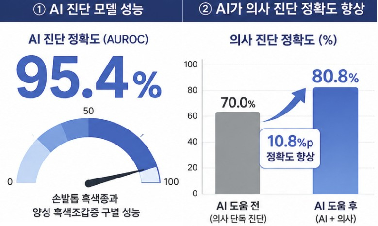 AI 진단 모델의 손발톱 흑색종과 양성 흑색조갑증 구별 정확도는 95.4%를 기록했다. 또 AI 도움을 받아 진단했을 때, 의사 진단 정확도가 10.8% 상승했다. /자료=해당 연구팀
