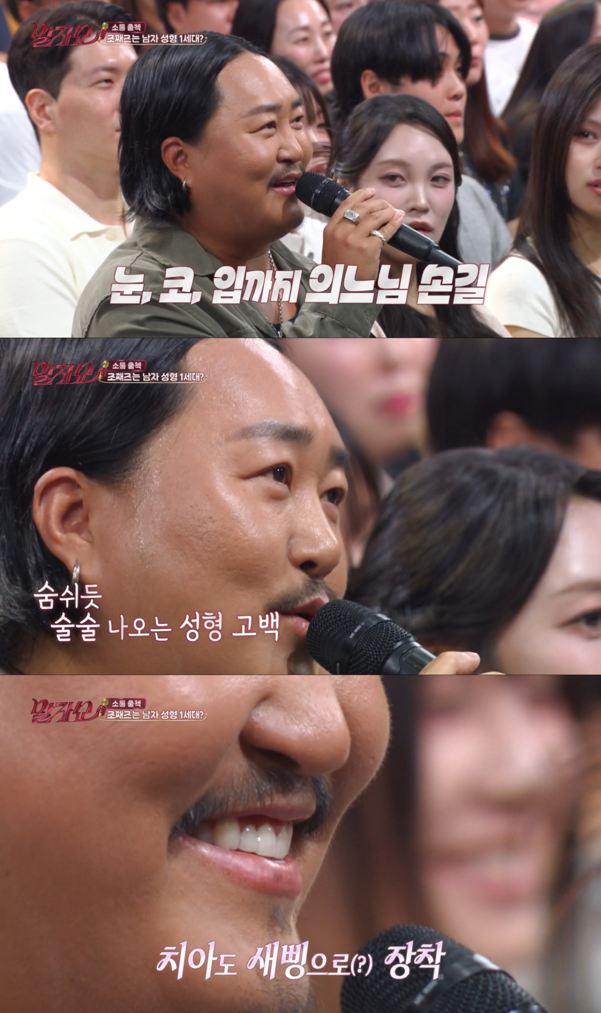 20년 전 눈, 코를 성형하고 최근에 치아도 성형한 조째즈. /사진=KBS2 '말자쇼' 캡처