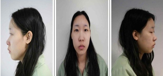 사진은 '강북구 모텔 연쇄 살인' 피고인 김소영(20)./사진제공=서울북부지검.