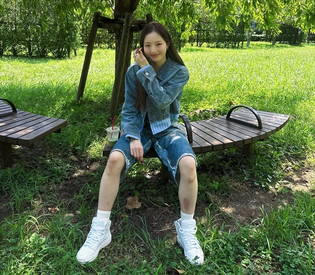 다리에 멍자국이 있는 혼다 마린. /사진=혼다 마린 공식 SNS