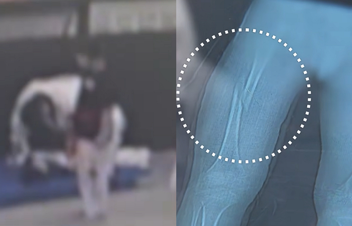 경기 용인시 한 태권도장에서 7세 남아에게 '다리찢기'를 시켜 골절상을 입힌 30대 관장이 아동학대 혐의로 고소당했다./사진=SBS