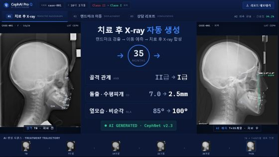 교정치료 결과 예측 및 시각화 AI 플랫폼/사진=퀀타큐브