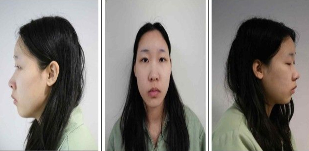 '모텔 약물 살인' 피고인 김소영(20)./사진제공=서울북부지검.