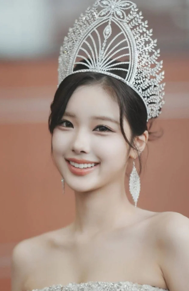 2025년 미스코리아 진 정연우(25)가 미스코리아 참가자들의 성형수술에 대해 소신 발언을 했다./ 사진=정연우 인스타그램