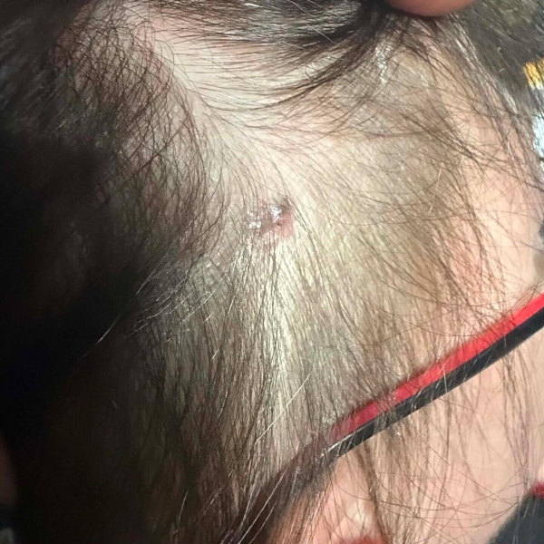 영국의 30대 여성이 미용실에서 머리를 손질하다가 미용사의 도움으로 머리에 생긴 '암 덩어리'를 없앤 사연이 전해졌다. /사진=SWNS