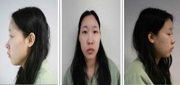 사진은 '모텔 약물 살인' 피고인 김소영(20)./사진제공=서울북부지검.