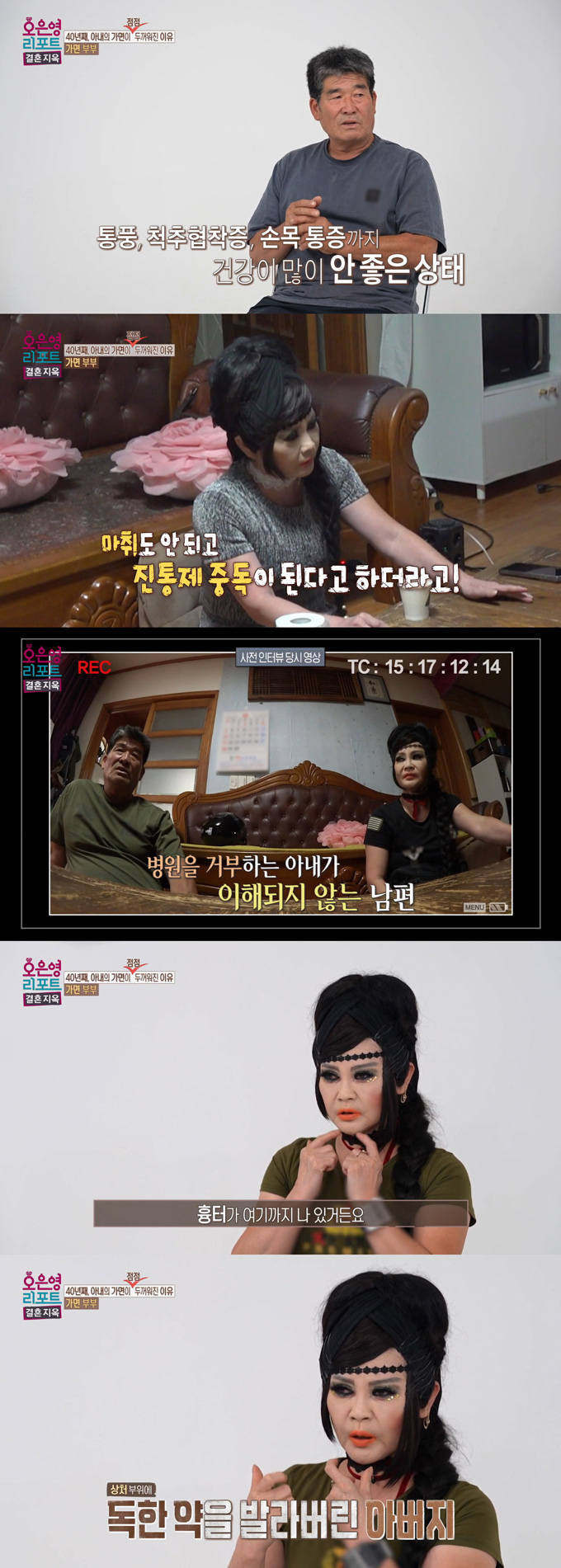 30년간 머리를 기르고 짙은 화장을 한 채 생활하는 아내가 시누이의 폭언과 남편의 가정폭력을 고백했다. /사진=MBC '오은영 리포트-결혼 지옥' 방송 화면