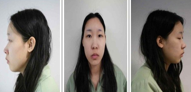 '모텔 약물 연쇄살인' 피고인 김소영(20)./사진제공=서울북부지검.