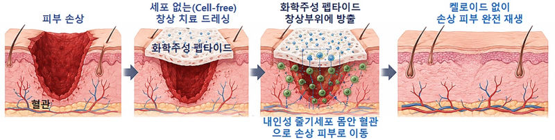 아주대 연구진이 새로 개발한 액티브 드레싱 SP1+Cx-SIS를 활용한 치료 과정을 보여주는 이미지./사진제공=아주대