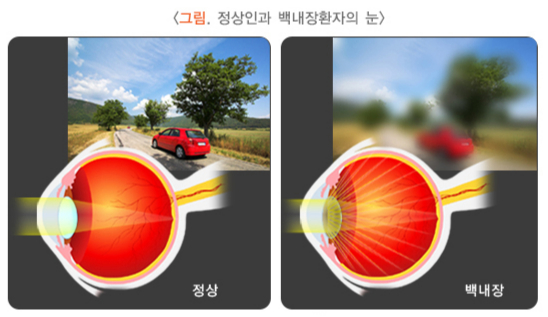 /자료=국가건강정보포털