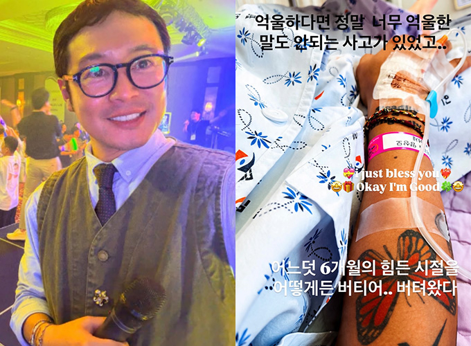 그룹 UP 출신 배우 이켠이 사고 부상으로 약 6개월간 힘겨운 시간을 보냈다고 밝혔다. /사진=이켠 인스타그램