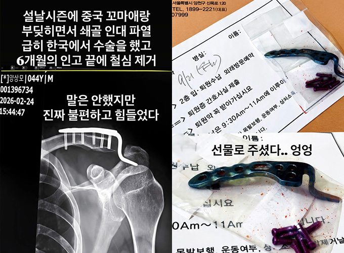 그룹 UP 출신 배우 이켠이 사고 부상으로 약 6개월간 힘겨운 시간을 보냈다고 밝혔다. /사진=이켠 인스타그램