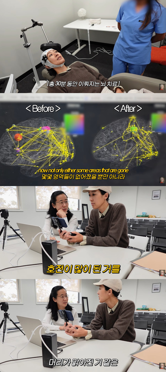 모델 겸 방송인 홍진경이 기억력 저하를 호소하며 미국에서 뇌 검사와 치료 를 받았다. /사진=유튜브 채널 '공부왕찐천재 홍진경' 영상