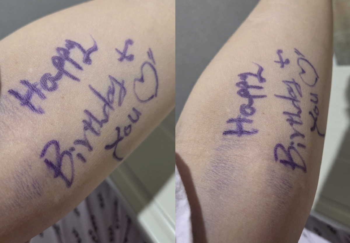 A씨는 수술 후 보게 된 생일 축하 메시지에 감동을 받았다며 사진을 공개했다/사진=A씨 제공