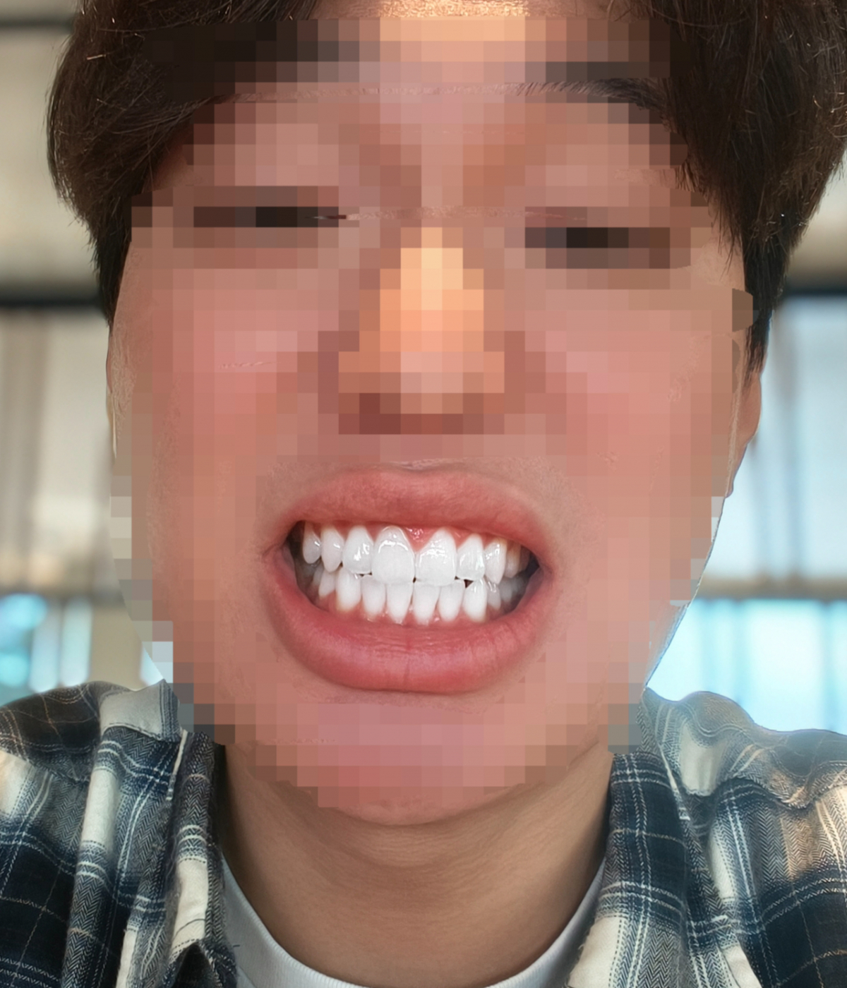 샤오미 17T 인물모드로 찍은 기자의 셀카(셀프카메라). 치아 미화 기능을 최대로 올리자, 치아가 라미네이트한 것처럼 하얗다./사진=이찬종 기자