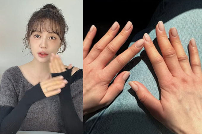배우 윤은혜가 심각한 알레르기 증상으로 고생했다고 고백했다. /사진=유튜브 채널 '윤은혜' 영상