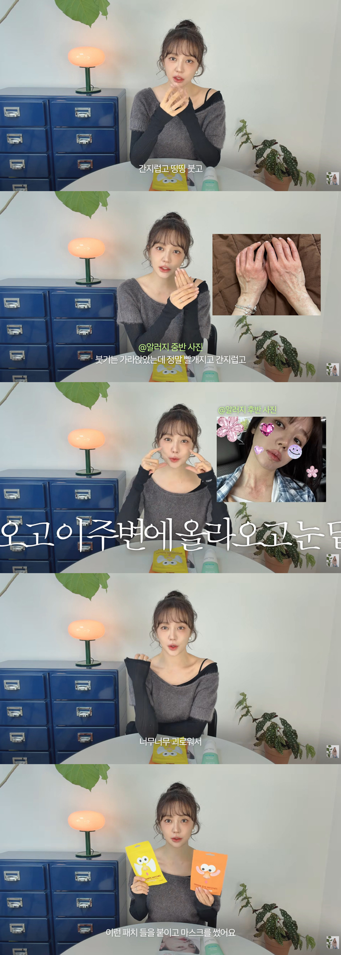 배우 윤은혜가 심각한 알레르기 증상으로 고생했다고 고백했다. /사진=유튜브 채널 '윤은혜' 영상