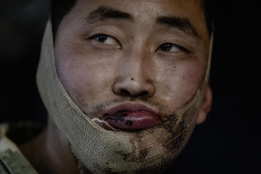 우크라이나가 작년 1월 공개한 북한군 포로 사진. (젤렌스키 대통령 X 캡처) 2025.1.12 ⓒ 뉴스1