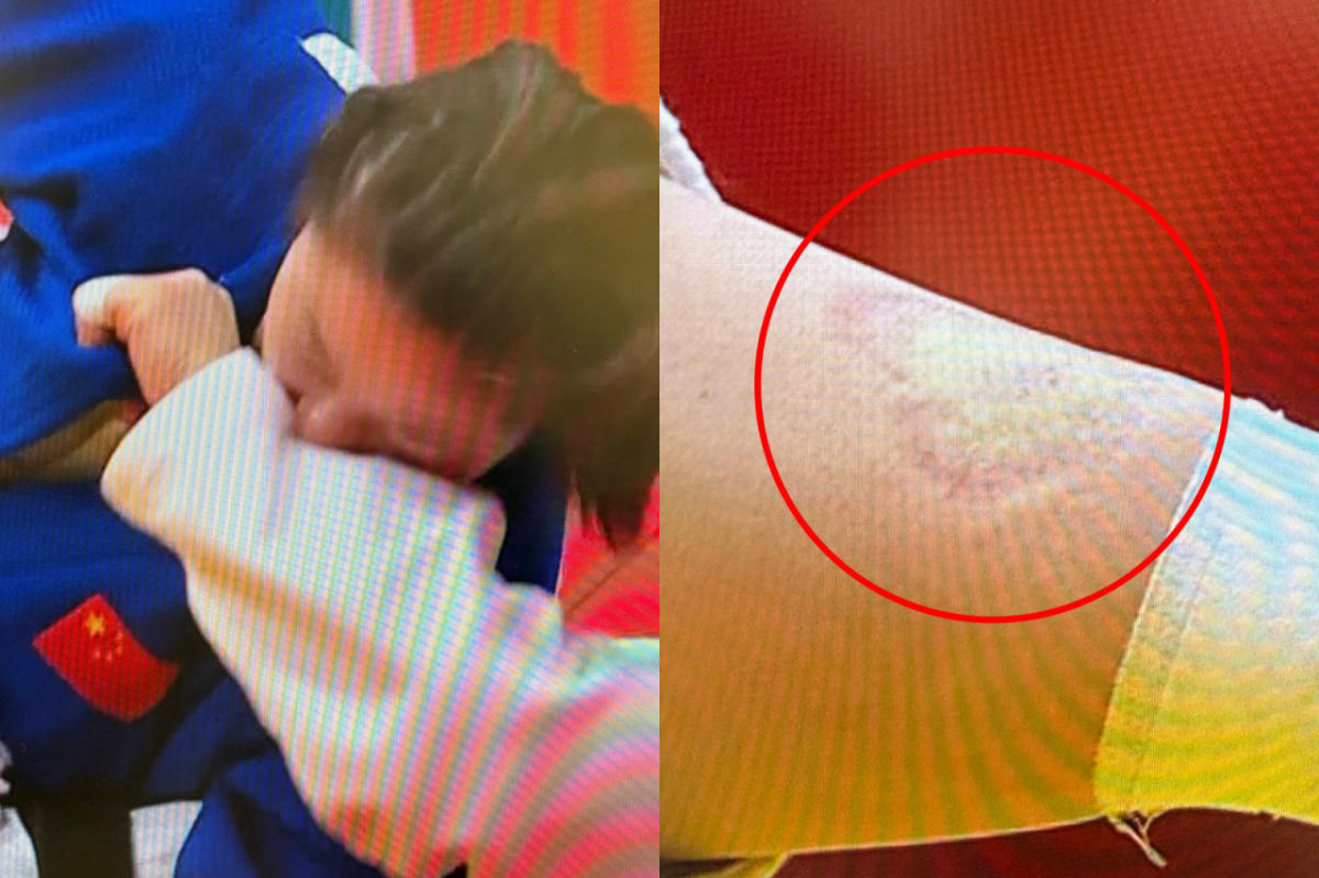 유도 경기 도중 중국 선수가 상대 선수의 팔을 깨문 황당한 일이 벌어졌다. 피해 선수는 6시간이 지난 뒤에도 선명하게 남은 이빨 자국을 공개했다. /사진=@chippin10 엑스(X, 구 트위터)