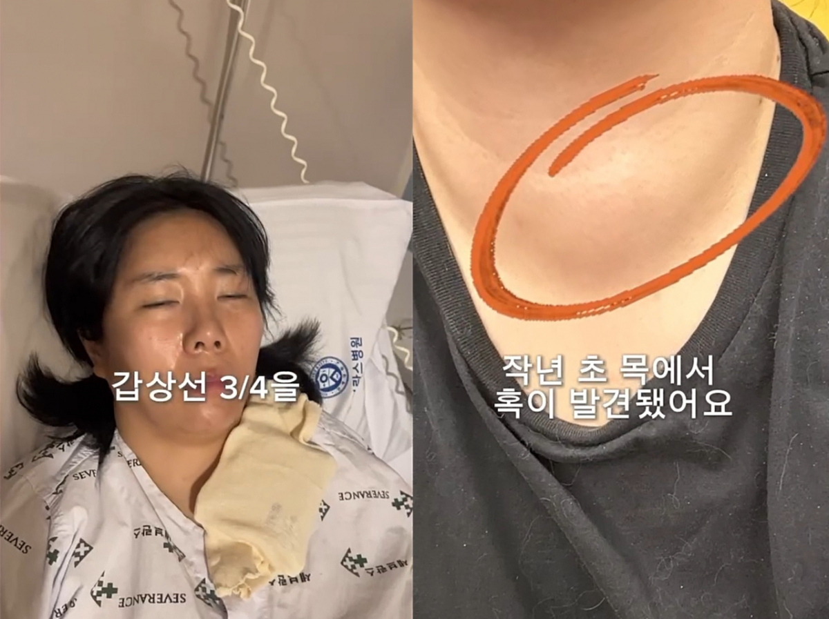 Heo An-na reported a sharp decline in physical stamina following thyroid resection surgery. /Photo=Instagram screenshot
