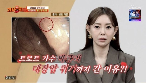 가수 박규리(47)가 대장암 직전까지 갔다고 털어놨다./사진=TV조선 '기사회생'