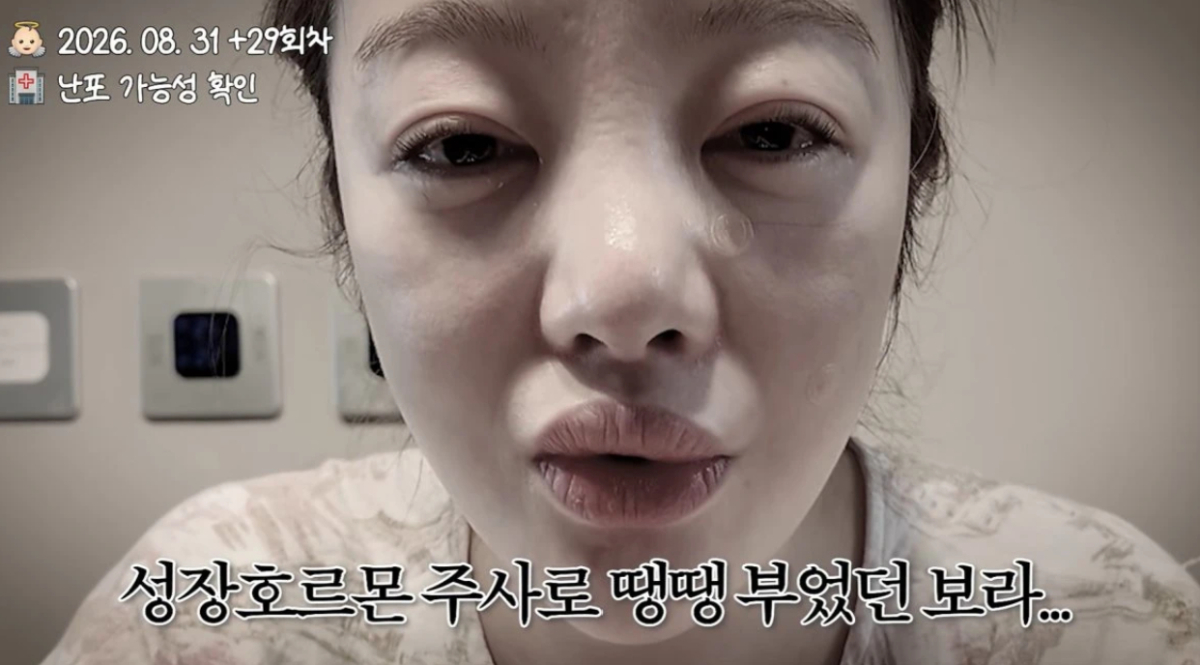 배우 황보라(43)가 둘째 임신을 위한 시험관 시술을 도전하던 중 주사 부작용으로 퉁퉁 부은 모습을 공개했다. / 사진='황보라 보라이어티'