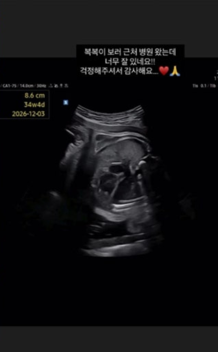아야네는 병원에서 촬영한 초음파 영상을 공개하며 "너무 잘 있다. 걱정해주셔서 감사하다"고 전했다./사진=아야네 인스타그램 캡처