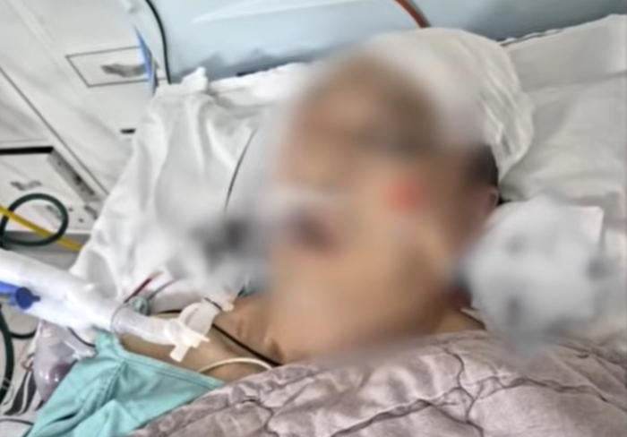 요양뱡원에서 같은 병실을 쓰던 환자를 소화기로 때려 숨지게 한 70대 남성에게 징역 15년이 선고됐다. 유족은 병원의 부실한 대응으로 피해자를 살릴 기회를 놓쳤다며 손해배상소송을 제기했다. /사진=JTBC '사건반장'