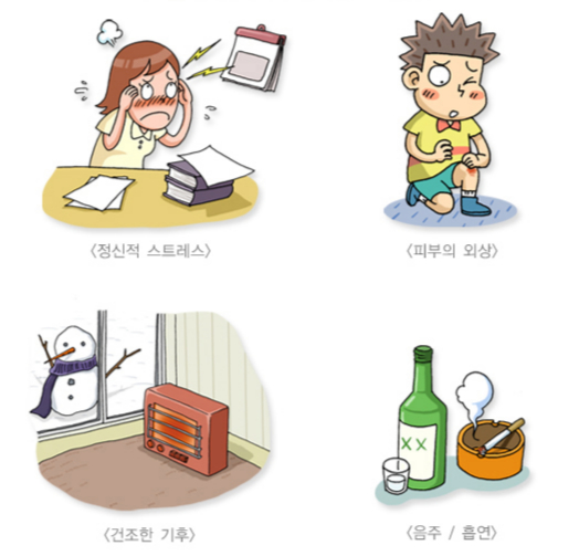 일상에서 건선을 악화하는 요인들. /자료=국가건강정보포털