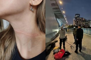 "목숨 잃을 뻔"...밤길 자전거 탄 여성 목 휘감은 '이것' 정체