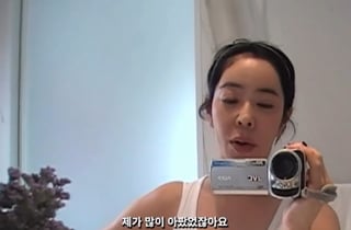 이혜영, 폐암 투병 후 부은 눈…"좌절 많이 했다" 후유증 고백