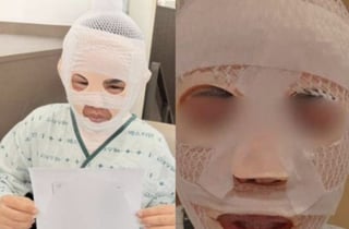 "딴 남자 만날까봐" 아내 얼굴에 끓는 물 부은 남편...징역 3년6개월