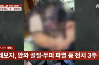 깜빡이 켰을 뿐인데…"기분 나빠" 문 벌컥 열고 택시 기사 무차별 폭행