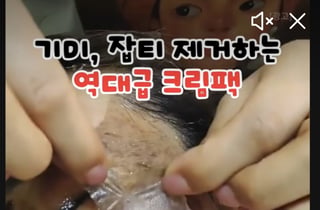 "기미 싹 빠진다" 연예인 인증템?..."피부 화끈하기만" 과장광고에 속았다