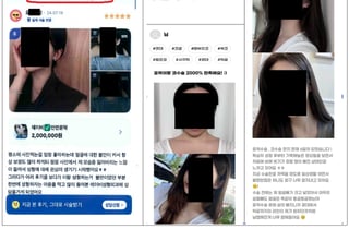 "윤곽이랑 코수술 2000% 만족해요"…알고보니 성형외과 뒷광고였다