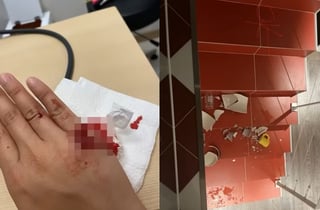 "박나래가 얼굴에 두 차례 술잔 던져"...한 번만 '특수폭행' 인정된 이유