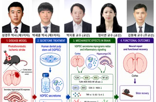 전남대 줄기세포분비체연구단·GIST 이코노어연구단, 뇌졸중 치료 가능성 제시