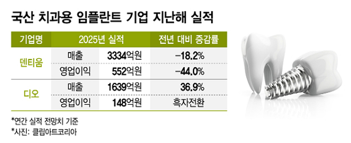 中변수에 엇갈린 치과용 임플란트…덴티움 울고, 디오 웃었다