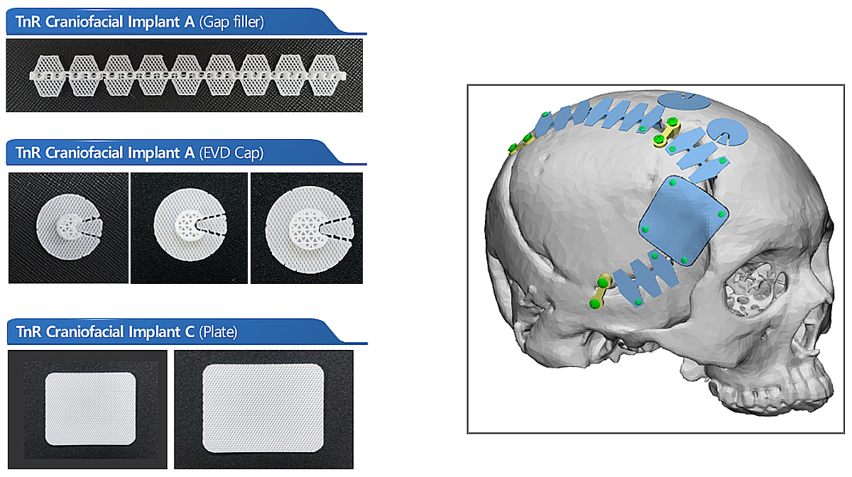 티앤알바이오팹, CB 상환부담 해소..."유동성 문제 해결, 올해 도약" - 뉴스 썸네일 이미지