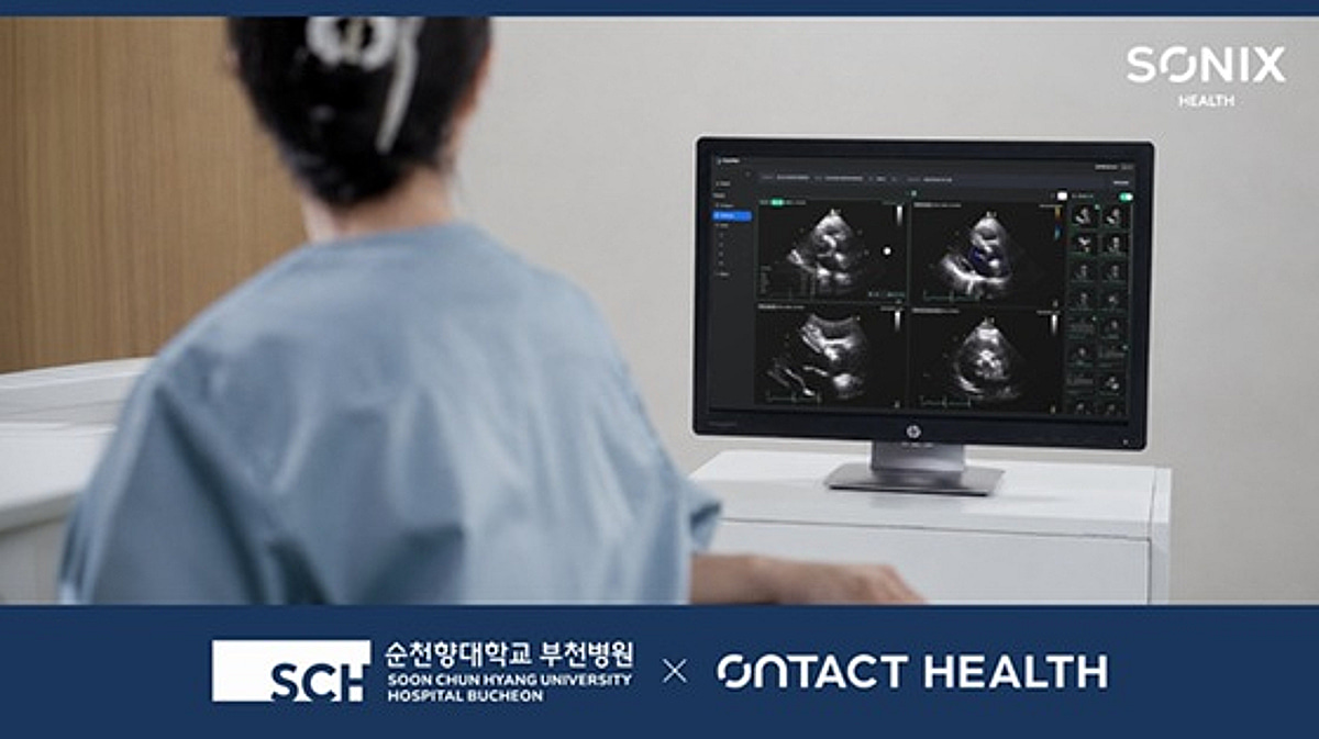 온택트헬스, 순천향대 부천병원에 심장초음파 AI '소닉스헬스' 공급