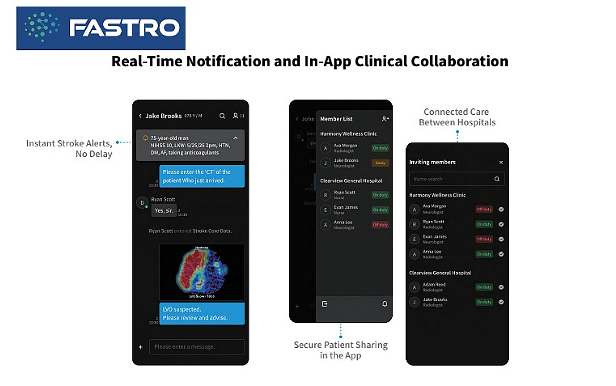 美 뇌졸중 가이드라인 발표에…제이엘케이, 글로벌 시장 선점 '기대감'