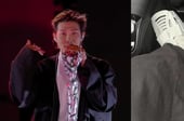 방탄소년단 RM도 못 피했다…발목 염좌, 한의학서 '이 치료' 했더니